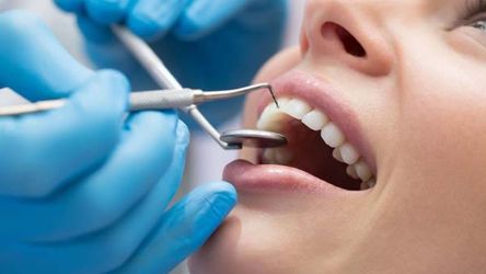Як усунути зубний наліт без відвідин стоматолога
